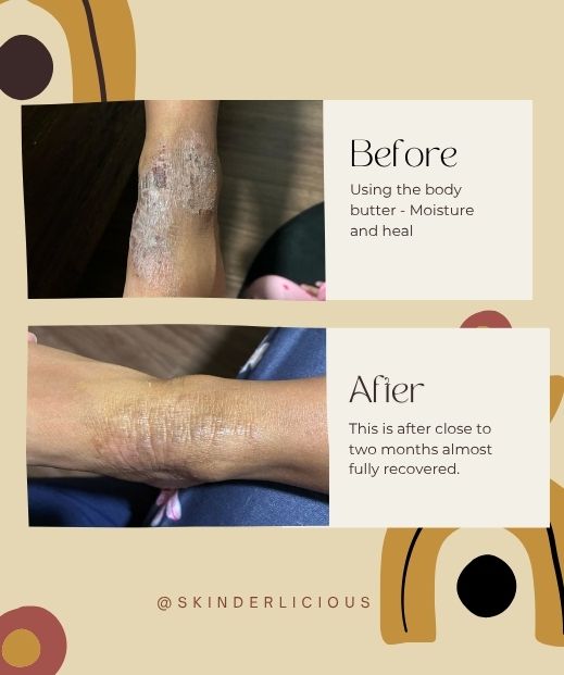 A True Healing Journey